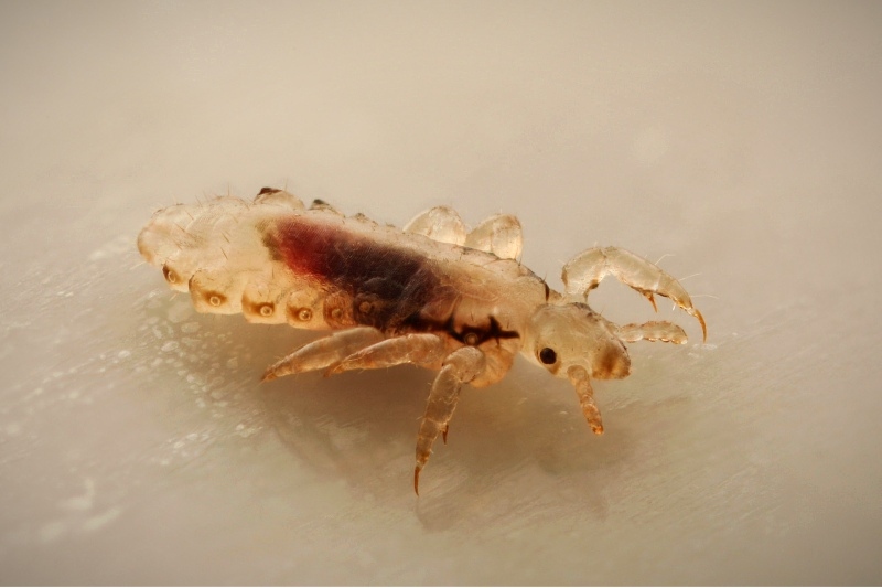 head lice