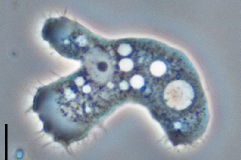 Acanthamoeba
