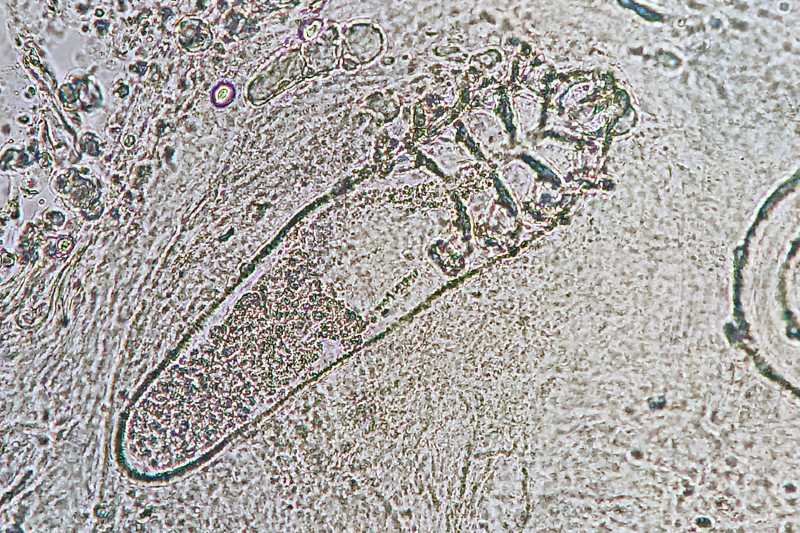 Demodex